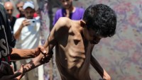 وفيات-جديدة-جراء-التجويع-في-غزة-ترفع-الحصيلة-إلى-162..-معظمهم-أطفال
